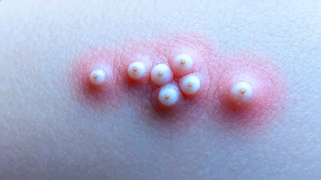  珍珠美容皮肤特写3140#横屏 	 