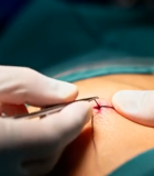 医生手术室进行手术操作1116#横屏 