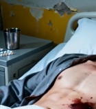  受伤男子躺病床6776#竖屏 	 