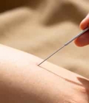  中医针灸疗实拍3222#横屏 	 