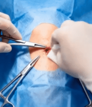 医生手术室进行手术操作3644#横屏 